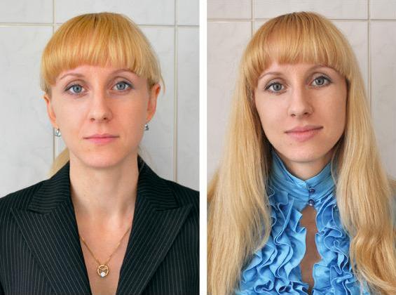 Ботокс для увеличения губ фото Ботокс для увеличения губ фото